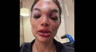 Dentista relata agressões do marido, empresário da Faria Lima, cita taco de beisebol e diz que segurança refutou ajuda