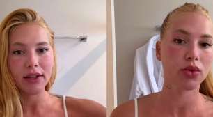 'Ia fazer um lifting, mas como eu vou viajar, vou...': aos 27 anos, Virginia Fonseca surge com rosto inchado e explica aparência diferente após novo procedimento estético