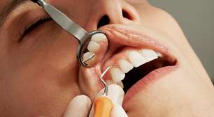 Pesquisa associa nanoestrutura de dentes à evolução da dieta humana