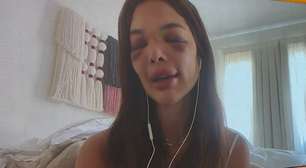 'Eu não sabia para onde correr': esposa de Ivo Kos relata histórico de violência