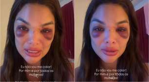 Dentista agredida por empresário Ivo Kos faz desabafo emocionante após repercussão do caso