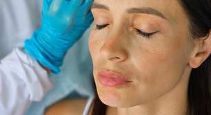 Como Prolongar os Efeitos do Botox de Forma Segura