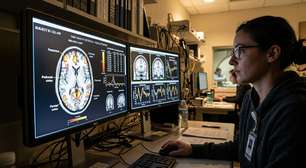 Cérebro pode raciocinar sem palavras, indica estudo de neurocientistas