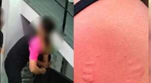 Professora denuncia instrutor após ser agarrada e mordida em academia do Recife