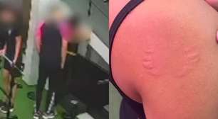 Mulher denuncia assédio após ser mordida e agarrada por instrutor de academia em Pernambuco