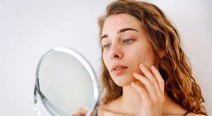 Skincare para pele acneica: o que funciona de verdade