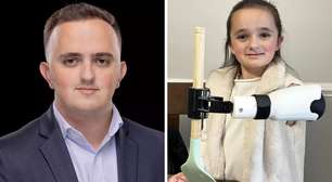 Aos 22 anos, estudante passou mais de 100 horas criando uma prótese multiferramenta para sua irmã de 7 anos em uma impressora 3D