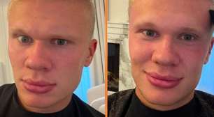 Haaland muda radicalmente de visual antes de jogo do City; vídeo
