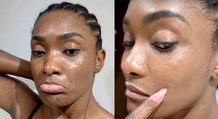 Erika Januza relata reação alérgica e mantém rotina nas gravações