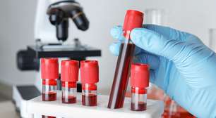Exame de sangue para Alzheimer pode ajudar a detectar o declínio cognitivo precoce
