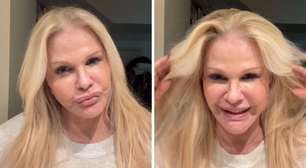 Monique Evans celebra resultado de plástica após superar rosto 'atropelado por caminhão'