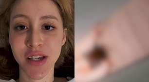 Influenciadora pede orações após sofrer fratura grave: 'Orem por mim'