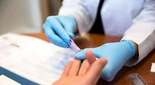 Mais de 20 milhões de pessoas com HIV terão mais de 50 anos até 2040, diz estudo