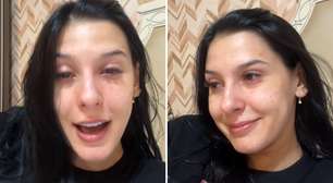 Ana Castela gera polêmica com remédio controlado e psiquiatra faz alerta: 'Risco'