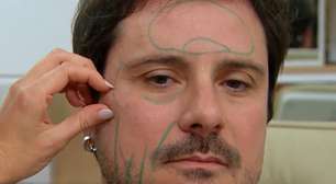 Ator de novela da Globo faz harmonização facial e surpreende com resultado no SBT: 'Nossa'; veja