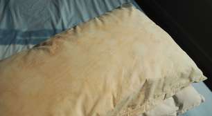 Travesseiro amarelado: o que as manchas podem revelar sobre a higiene da cama