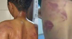 Pai espanca filho de 13 anos por usar brincos em Pernambuco: "Era para eu ter matado ele"
