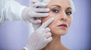 Lifting facial: 7 coisas que você precisa saber antes de fazer