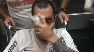 Santos FC e Estado de SP são condenados a pagar R$ 90 mil a torcedor que perdeu o olho após confusão na Vila