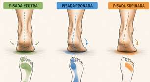 Existem 3 tipos de pisada. Qual é a sua e o que isso muda ou não no tênis de corrida