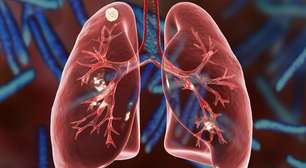 Fibrose cística: entenda a doença, os sinais e por que a conscientização é tão importante