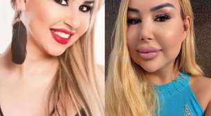 Cantora trans portuguesa revela consequências do silicone industrial e quase R$ 1 milhão em cirurgias