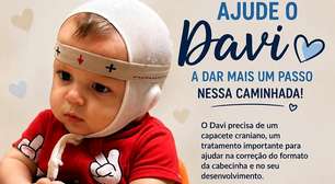 Uma esperança para Davi: como você pode ajudar no tratamento de plagiocefalia
