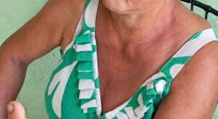 Adolescente é apreendido suspeito de decepar dedo da sogra com foice na Paraíba