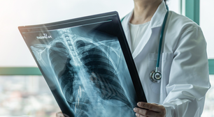 Hospital Moinhos de Vento apresenta estudo clínico de tratamento ao Câncer de Pulmão em população adulta com diagnóstico ativo.