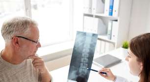 Cirurgia de coluna: avanços derrubam mitos e melhoram técnicas
