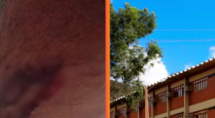 UFRPE é condenada a indenizar estudante atacado por cães dentro de campus em Serra Talhada
