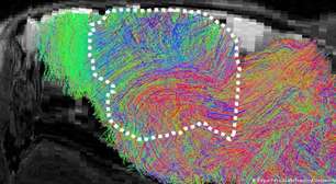 Cientistas implantam tecido cerebral humano em ratos