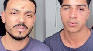 Casal gay denuncia agressão homofóbica após festa na UFRJ: "Quer apanhar, viadinho?"