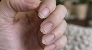 O erro acontece antes mesmo do esmalte: 5 hábitos que deixam as unhas fracas e descamando com frequência