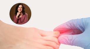 Micose e unhas esfarelando: o que significa?