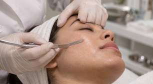 A tendência promete remover pelos e deixar a pele mais lisa, mas o dermaplaning caseiro pode cobrar um preço alto