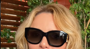 Rita Guedes conta o que aconteceu após blefaroplastia e revela que correu risco de perder a visão