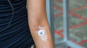 Cientistas criam uma tecnologia de tatuagem que não dói e dispensa agulhas mas a escolha dos desenhos ainda é bastante limitada