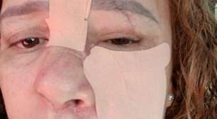 A luta corajosa de Agda pela recuperação facial após um grave acidente de bicicleta