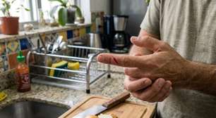 Quando um corte precisa de ponto? Estes sinais merecem atenção