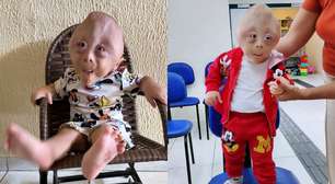 Bebê com condição ultra-rara sensibiliza a web: conheça a história de Gabriel Esdras