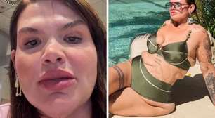 Thais Carla se prepara para cirurgia de remoção de pele após perder 120 kg: 'Virada de vida'