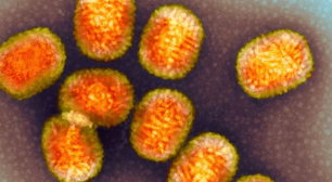 Cientistas acabam de descobrir que este vírus roubou um pedaço do nosso DNA... e agora o usa contra nós!