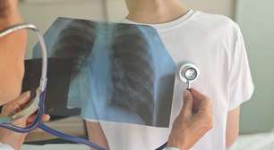 Pneumonia que não melhora ou vive voltando: quando investigar além da infecção