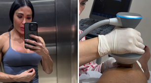 Gracyanne Barbosa recorre a punção para retirar líquido do joelho por conta do 'Dança dos Famosos'