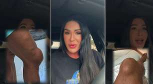 Gracyanne Barbosa mostra joelho inchado e desabafa sobre impacto de treinos da 'Dança dos Famosos'