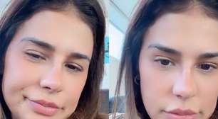 Como ficou o novo nariz de Simone Mendes? Resultado divide opiniões e cantora revela intimidade com Kaká Diniz: 'Ele me acha a mulher mais linda do mundo'