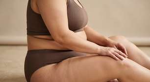 Gordura localizada ou lipedema? Saiba como diferenciar