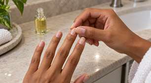 Óleo de cutícula ajuda a reduzir o aspecto ressecado ao redor das unhas, mas não substitui cuidado quando há dor ou inflamação