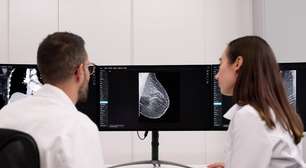 Testada com 105 mil mulheres, inteligência artificial atua como segunda leitura em mamografias e ajuda a identificar o câncer de mama precocemente